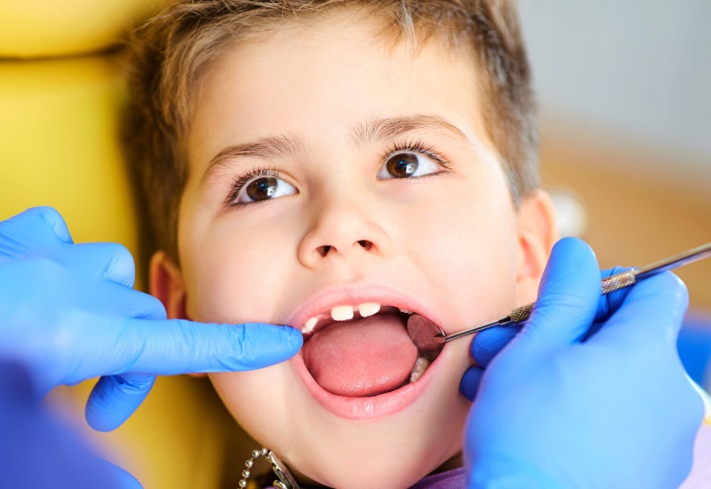 طب-أسنان-للأطفال